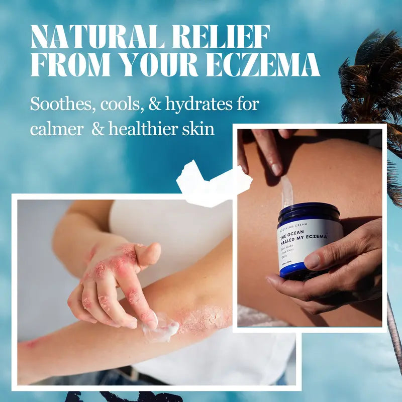 All Natural Eczema Soothing Cream | Made with Sea Moss! Sensitive Skin Dry Skin Hydrating Comfort Moisture | Fragrance Free Skincare Moisturizer Skin Repair